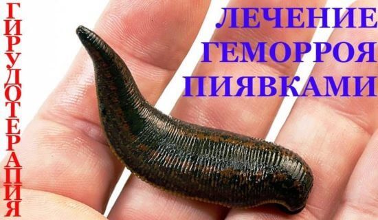 Каков лечебный эффект гирудотерапии при лечении геморроя?