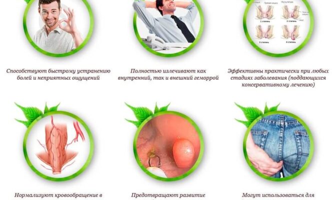 Причины и профилактика геморроя