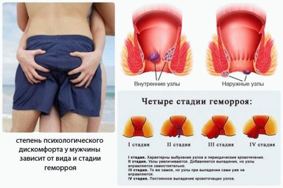 Застойные явления