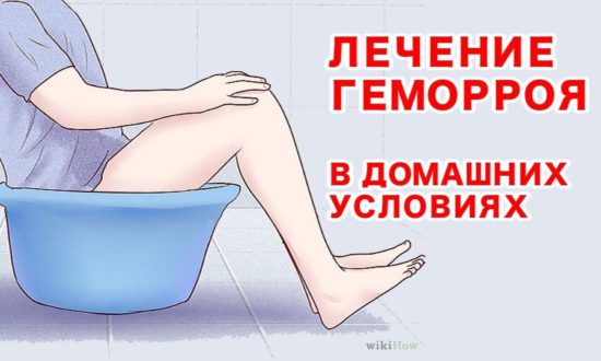 Как лечится геморрой в домашних условиях?