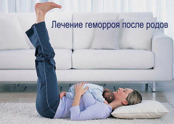 Лечение геморроя после родов